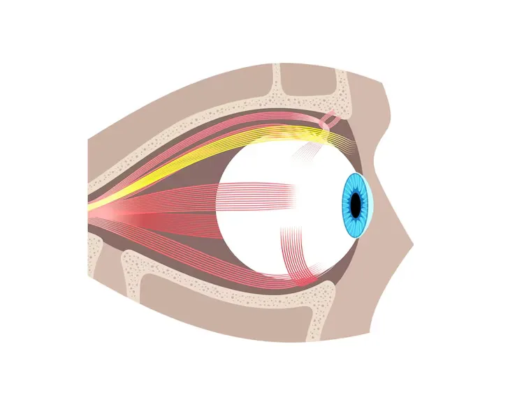 Diagram showing a cross-section of the human eye socket, illustrating the optic nerve (yellow) and extraocular muscles (red) attached to the eyeball.
