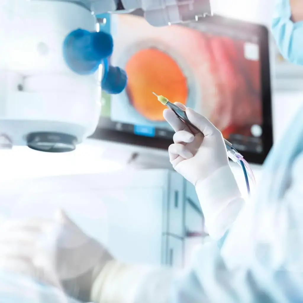 Surgeon's gloved hand holding a surgical tool during eye surgery, with a magnified view of an eye visible on a monitor in the background.